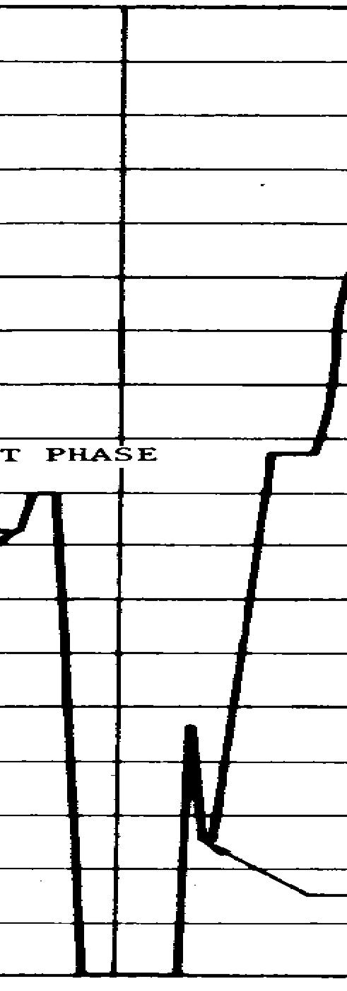 High-zoom crop of the bank-reversal region: near-vertical strokes diving to the bottom border of the plot, a narrow spike, and a long straight climb back up.